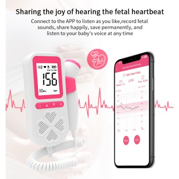 Naprava za poslušanje srčka v nosečnosti WaveBeat P90BT, Roza